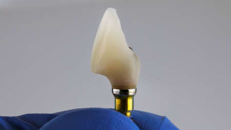 quality crown in the doctor's hand, side view on a white backgroundの写真素材