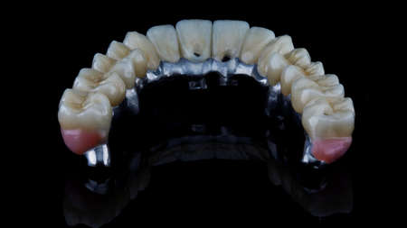 excellent glued ceramic crowns on the titanium beam of the prosthesis, the view from the inside on black glassの写真素材