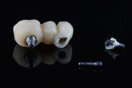 set Dental crowns and defects, not a successful work