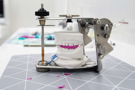 Articulator and study of bite for further treatment