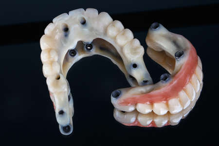 set of high-quality dentures for patients, orthopedic sphereの写真素材