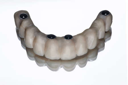 high quality ceramic prosthetic upper jaw, shot on a mirror with white background