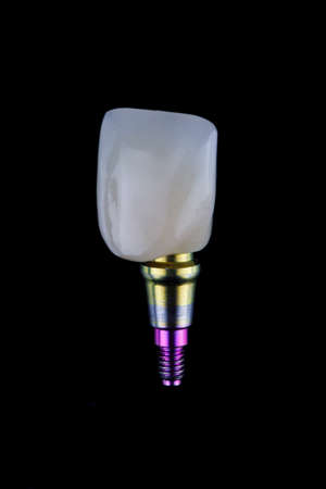 excellent dental crown and special abutment, top view on a black backgroundの写真素材
