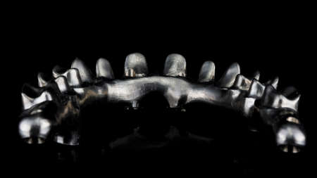 high-quality titanium beam for the manufacture of an upper jaw prosthesis, view from the inside of...