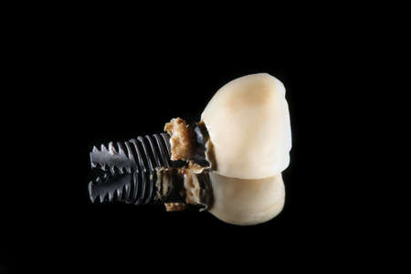 high-quality macro photography izvelechonnogo implant and crown, shot on black glass with reflection