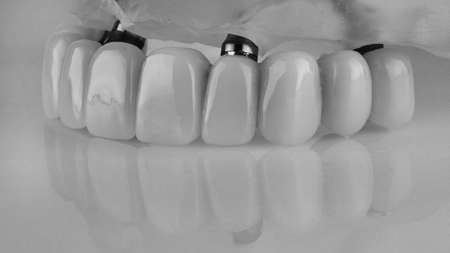 Black and White Photo Provence Upper Jaws on Special Modelの写真素材