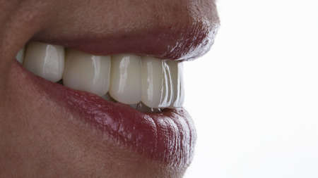 Beautiful smile with ceramic veneers with texture and relief on white background