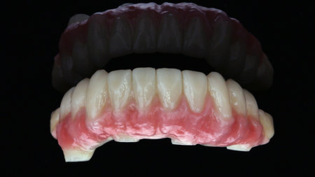 bright dental prosthesis made of zircon for the lower jaw on a black backgroundの写真素材