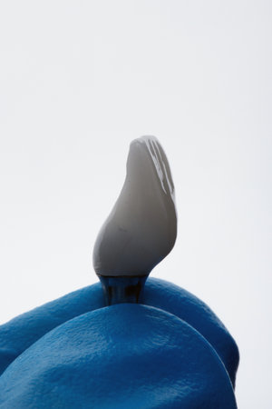 a dental crown for the central tooth on a white background
