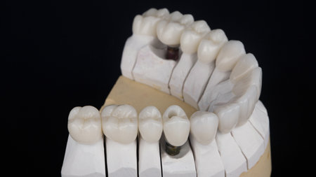 dental model with ceramic crowns on a black background