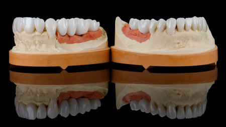zircon crowns and bridges on jaw models on black glass with reflectionの写真素材