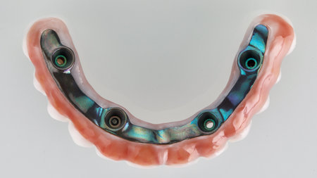 titanium beam in a zircon prosthesis with gum, top view on a white background
