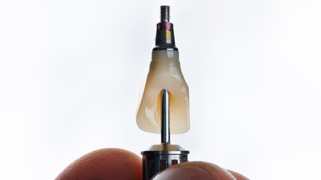 macro photo dental ceramic crown of the central tooth from ceramics on a white backgroundの写真素材