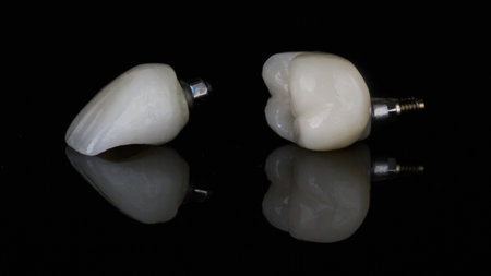 two beautiful dental crowns for the central and posterior teeth on black glass with reflection