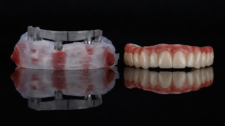 dental prosthesis with artificial gums of the upper jaw and a model with a metal beam on black glass with reflectionの写真素材