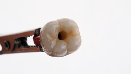 ceramic crown of a chewing tooth on a white background