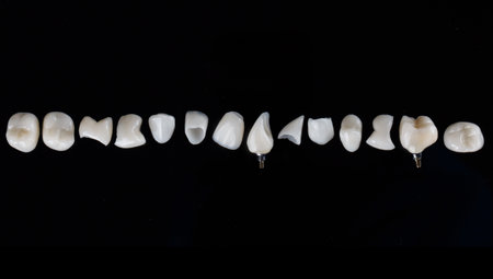 a row of ceramic dental veneers and high quality crowns, shot from above on a black background