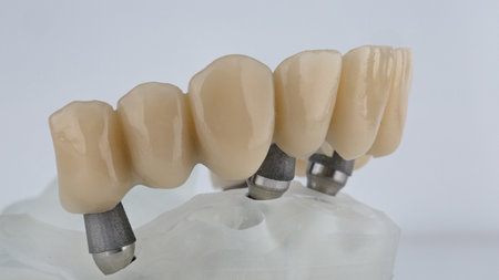 upper jaw prosthesis on model side view on white background