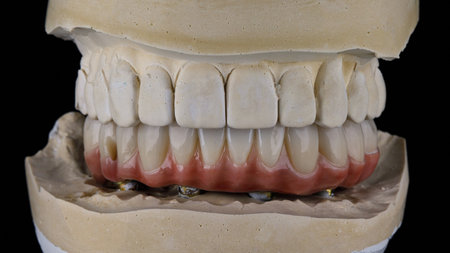 Dental Prosthetic Ceramics and Titanium with a model made of plaster in bite