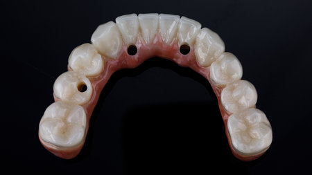 morphology of a dental prosthesis made of ceramic and titanium of the lower jaw, top view on a black backgroundの写真素材