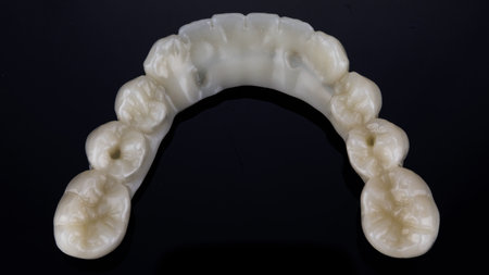 top view of the prosthesis of the lower jaw with the morphology of chewing teeth on a black...