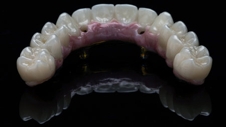 excellent morphology of the maxillary prosthesis on black glass with reflectionの写真素材