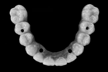 zircon prosthesis with tooth morphology on a black background. top view in black and white style