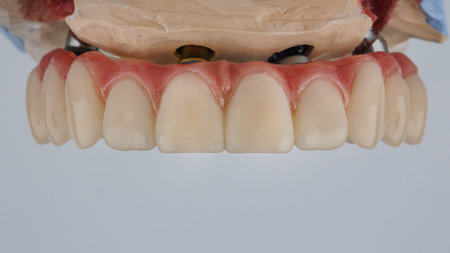 temporary dental prosthesis with artificial gum on the model and light background