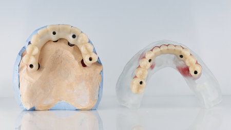 two temporary prostheses of the upper and lower jaws on models on a light backgroundの写真素材