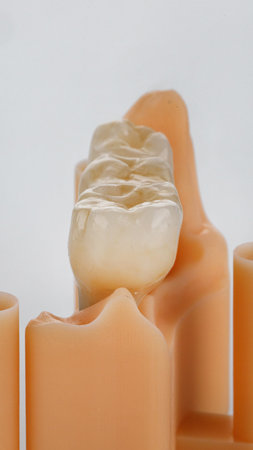 morphology of a zirconia bridge prosthesis on a polymer model on a white background