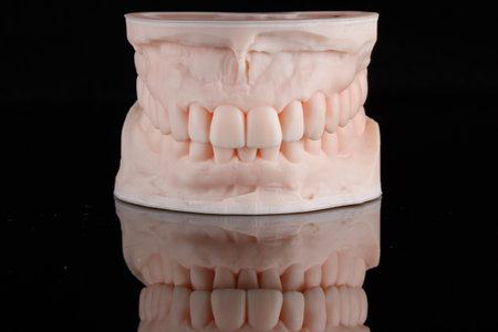 printed dental model of the upper and lower jaws in the bite on a 3D printer on black glass