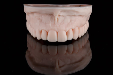 dental model of the upper jaw on a 3D printer, on black glass with reflectionの写真素材