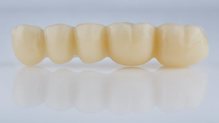 dental prosthesis made of polymer of natural color without a beam on a white backgroundの写真素材