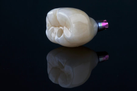 macro dental photo of ceramic crown on black glass with creative reflectionの写真素材