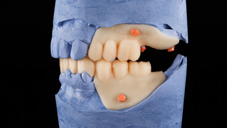 dental model with dentures mockup for bite study on black background