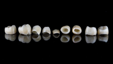 high-quality dental crowns for total prosthetics on black glass with reflectionの写真素材