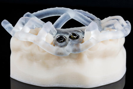 surgical dental template on a model with abutments for the implantation of two implants on a black...