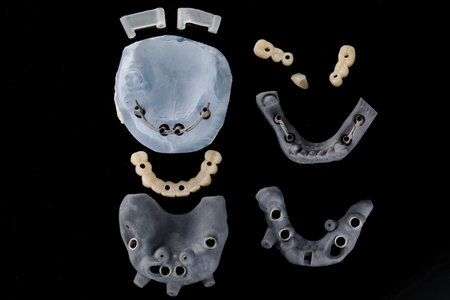 top view of a surgical dental template with dental templates for implantation and prostheses on a black backgroundの写真素材