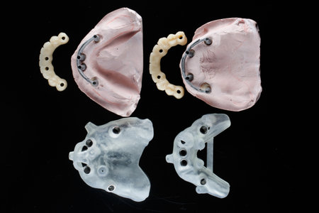 two dental models with bars and prostheses and two templates for implantation, top view on a black...