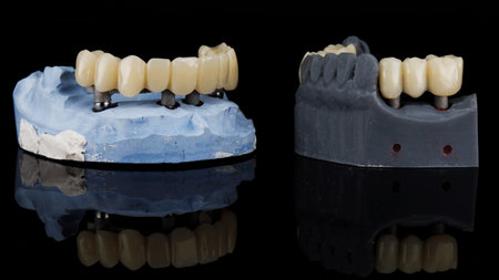 dental prosthesis of the upper jaw and two bridges on jaw modelsの写真素材