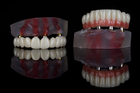 excellent dental composition of two models with upper and lower jaw prostheses on black glass with reflectionの写真素材