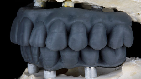 Technical prostheses for fitting and forecast for the model from the side