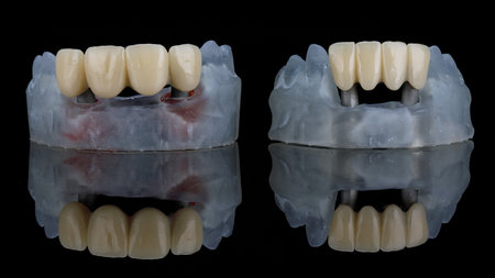 Two dental prosthesis made of plastic for central teeth on models, on black glass with reflection