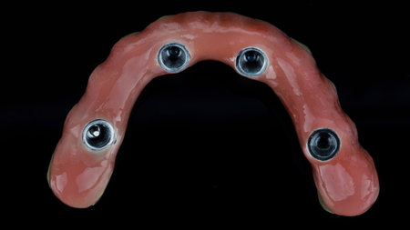 View of the gum prosthesis of the lower jaw from ceramic on a black backgroundの写真素材