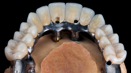 excellent morphology and relief of ceramic teeth on the prosthesis of the upper jaw on a black...
