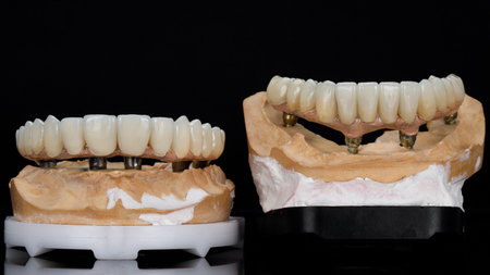 the process of manufacturing a dental beam from a beam and crowns of the upper and lower jaws on...
