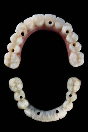 top view of two dental prostheses on a black background