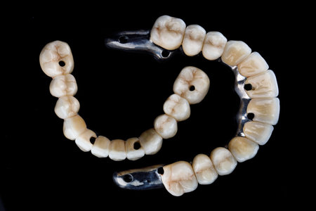 two dental prostheses on titanium beams, top view on a black background