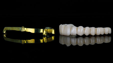 dental prosthesis of the upper jaw from zircon with a beam of gold-colored titanium on black glass with reflectionの写真素材