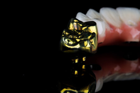 gilded teeth part of the prosthesis of the upper jaw on a black background with space for textの写真素材